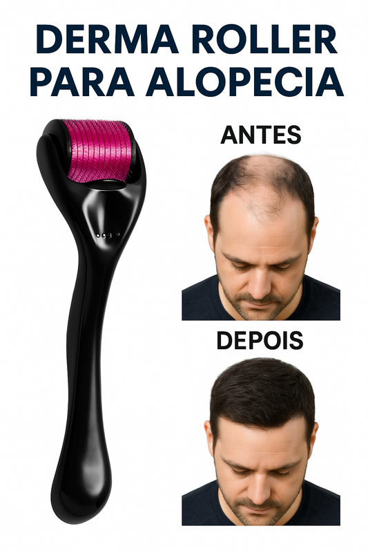 Derma Roller 540 Agulhas – Combate Eficaz à Alopecia