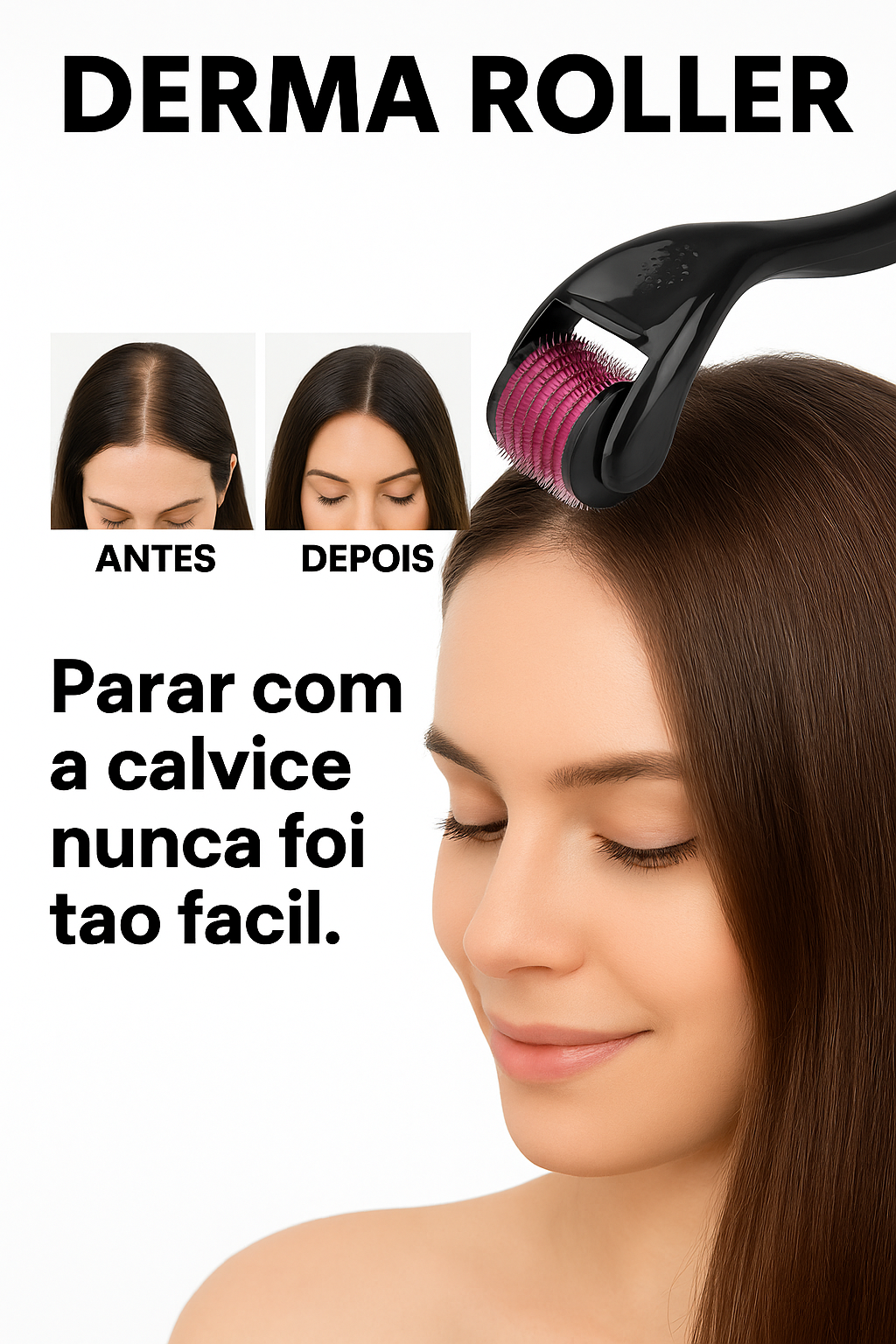 Derma Roller 540 Agulhas – Combate Eficaz à Alopecia