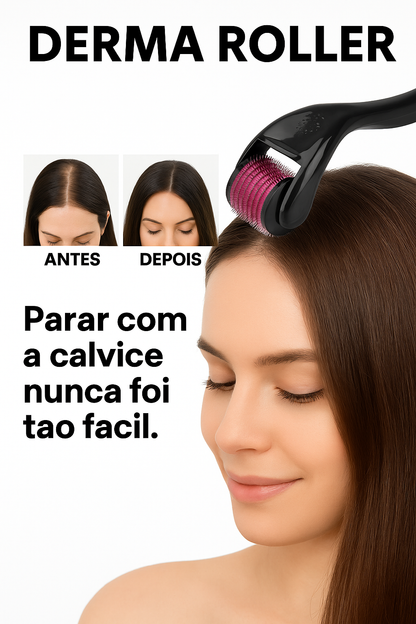 Derma Roller 540 Agulhas – Combate Eficaz à Alopecia